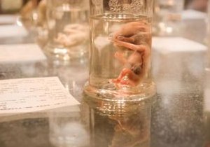 阳春市生孩子做染色体检查有必要吗，筛查一次大概需要多少钱？