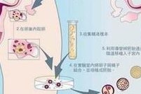 用特需做试管婴儿（特需做试管婴儿有多少人能接受呢）